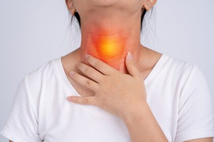 Tonsil-Stones